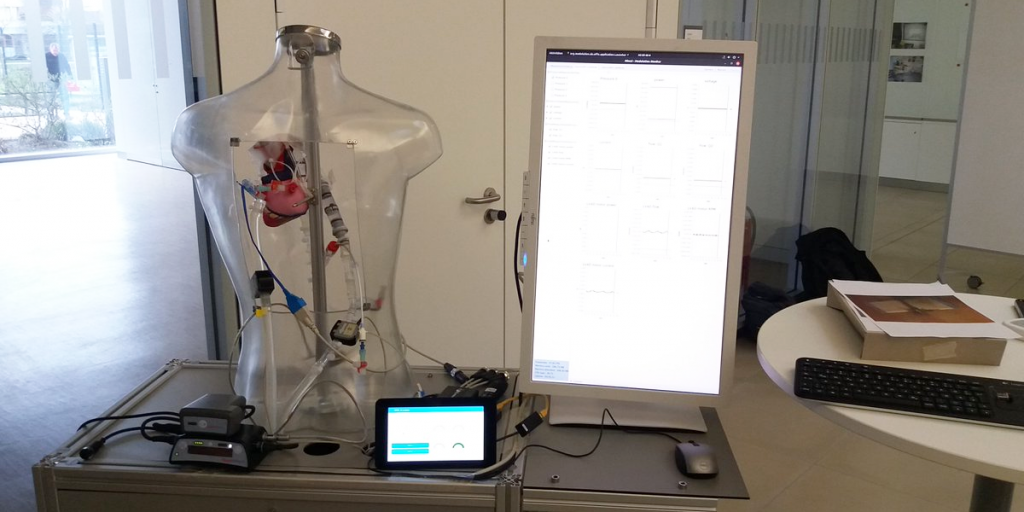 El proyecto Medolutiom ha desarrollado tecnología de chatbots para la monitorización integral de corazones artificiales.